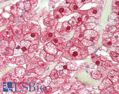 Human Adrenal: Formalin-Fixed, Paraffin-Embedded (FFPE)
