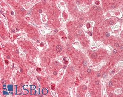 Human Liver: Formalin-Fixed, Paraffin-Embedded (FFPE)