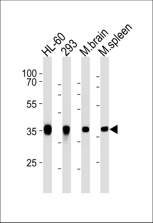 ALDOC Antibody western blot of HL-60,293 cell line and mouse brain,spleen lysates (35 ug/lane). The ALDOC antibody detected the ALDOC protein (arrow).