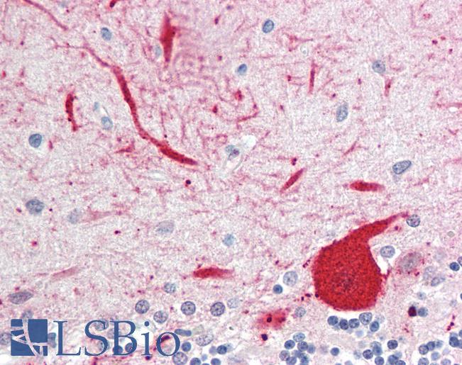 Anti-ALDOC / Aldolase 3 antibody IHC staining of human brain, cerebellum. Immunohistochemistry of formalin-fixed, paraffin-embedded tissue after heat-induced antigen retrieval. Antibody LS-B10404 concentration 10 ug/ml.