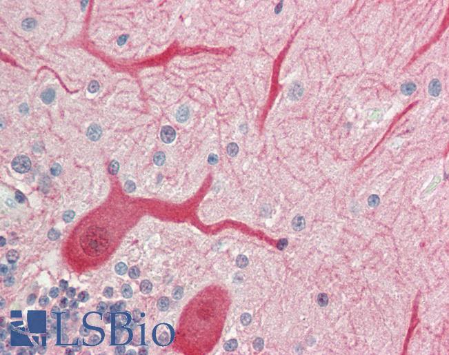 Human Brain, Cerebellum: Formalin-Fixed, Paraffin-Embedded (FFPE)