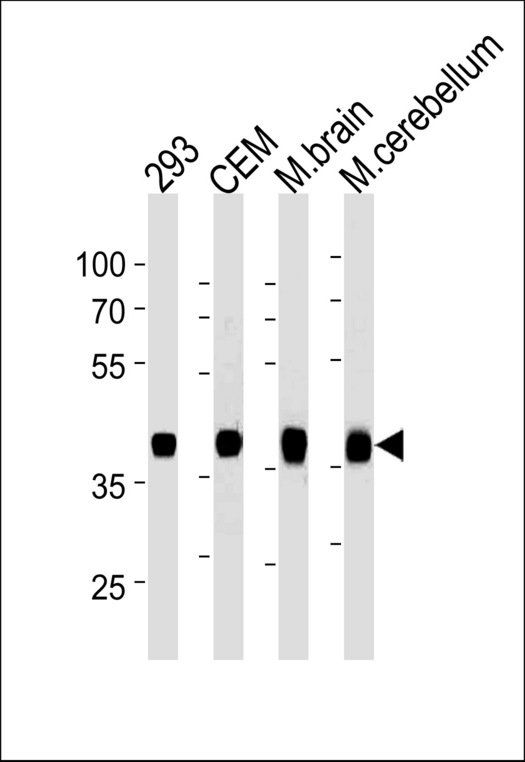 ALDOC Antibody western blot of 293,CEM cell line and mouse brain,cerebellum tissue lysates (35 ug/lane). The ALDOC antibody detected the ALDOC protein (arrow).