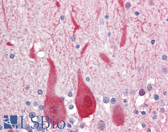 Anti-ALDOC antibody IHC of human brain, cerebellum. Immunohistochemistry of formalin-fixed, paraffin-embedded tissue after heat-induced antigen retrieval. Antibody LS-B3453 concentration 10 ug/ml.