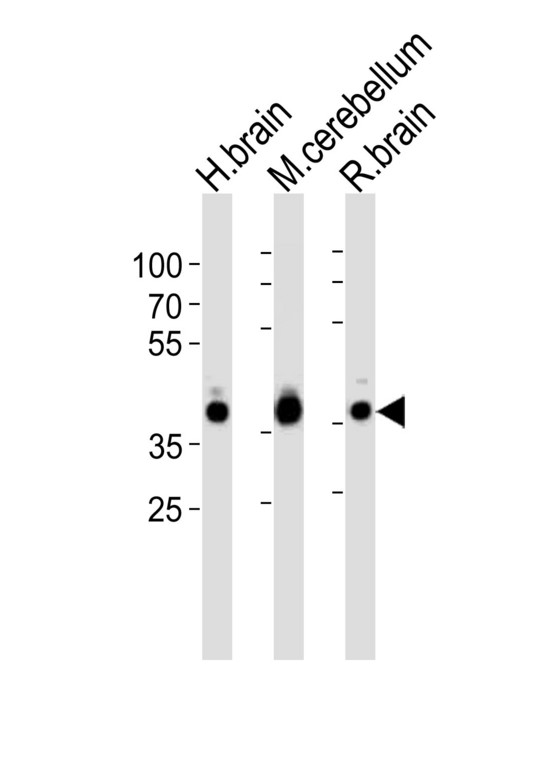 Western blot of lysates from human brain, mouse cerebellum and rat brain tissue lysate (from left to right), using ALDOC Antibody. Antibody was diluted at 1:1000 at each lane. A goat anti-rabbit IgG H&L (HRP) at 1:10000 dilution was used as the secondary antibody. Lysates at 35ug per lane.