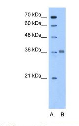 Lane A: Marker. Lane B: HepG2 cell lysate. Antibody concentration: 0.5 ug/ml. Gel concentration: 12%.