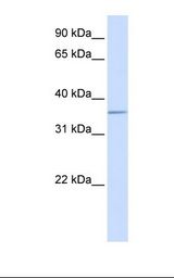 Placenta lysate. Antibody concentration: 1.0 ug/ml. Gel concentration: 12%.