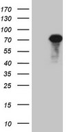 HEK293T cells were transfected with the pCMV6-ENTRY control (Left lane) or pCMV6-ENTRY ALOX12 (Right lane) cDNA for 48 hrs and lysed. Equivalent amounts of cell lysates (5 ug per lane) were separated by SDS-PAGE and immunoblotted with anti-ALOX12.