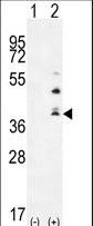 Western blot of TNFSF15 (arrow) using rabbit polyclonal TNFSF15 Antibody. 293 cell lysates (2 ug/lane) either nontransfected (Lane 1) or transiently transfected (Lane 2) with the TNFSF15 gene.