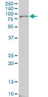 ALOX15 monoclonal antibody, clone 3D8 Western blot of ALOX15 expression in HeLa NE.