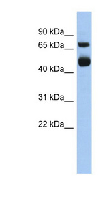 ALOX15 / 15 Lipoxygenase 1 antibody LS-C111783 Western blot of Fetal Heart lysate.