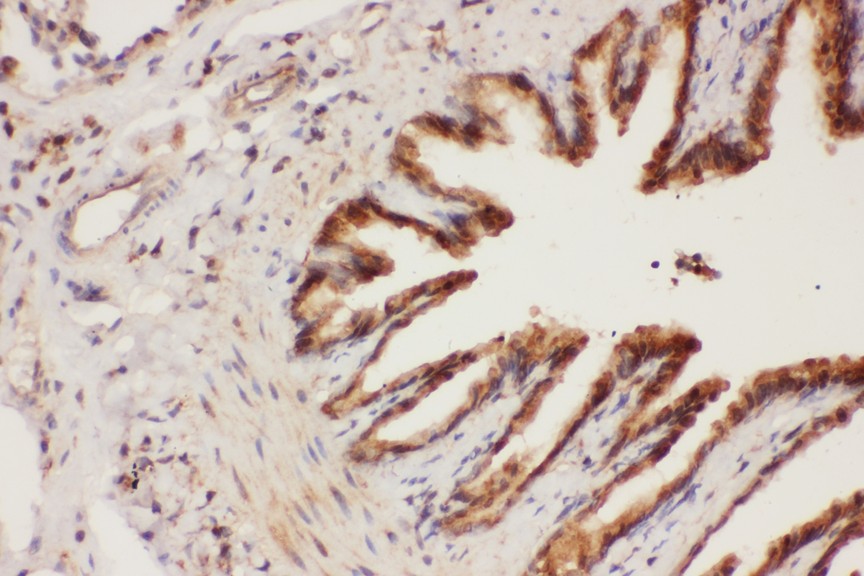ALOX15 antibody IHC-paraffin: Rat Lung Tissue.