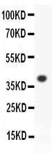 ALOX15 antibody Western blot. All lanes: Anti-ALOX15 at 0.5 ug/m. WB: Recombinant Human ALOX15 Protein 0.5ng. Predicted band size: 39 kD. Observed band size: 39 kD.