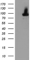 HEK293T cells were transfected with the pCMV6-ENTRY control (Left lane) or pCMV6-ENTRY ALOX15 (Right lane) cDNA for 48 hrs and lysed. Equivalent amounts of cell lysates (5 ug per lane) were separated by SDS-PAGE and immunoblotted with anti-ALOX15.