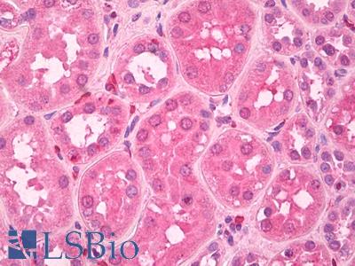 Anti-15-LOX / ALOX15 antibody IHC of human kidney. Immunohistochemistry of formalin-fixed, paraffin-embedded tissue after heat-induced antigen retrieval. Antibody LS-B7902 dilution 5 ug/ml.