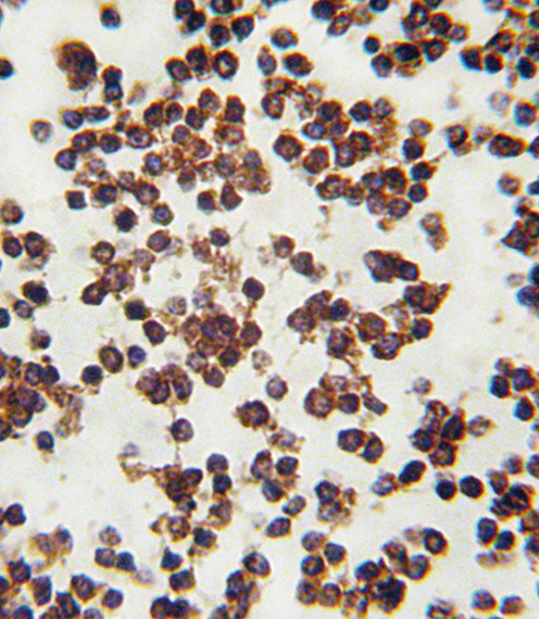 Formalin-fixed and paraffin-embedded human lymph tissue reacted with ALOX15 antibody , which was peroxidase-conjugated to the secondary antibody, followed by DAB staining. This data demonstrates the use of this antibody for immunohistochemistry; clinical relevance has not been evaluated.