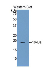 Western blot of recombinant 15-LOX / ALOX15.