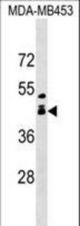 ALX1 Antibody western blot of MDA-MB453 cell line lysates (35 ug/lane). The ALX1 antibody detected the ALX1 protein (arrow).