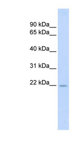 TNFSF18 antibody LS-C111108 Western blot of Placenta lysate.