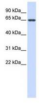 Western analysis of fetal small intestine lysate.