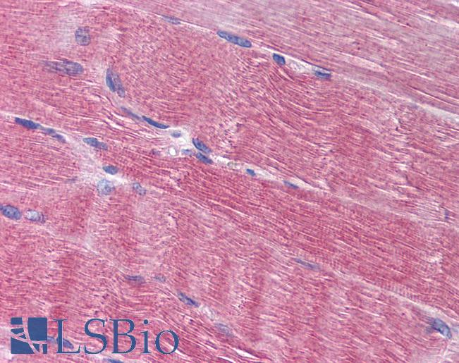 Anti-AMPD1 antibody IHC of human skeletal muscle. Immunohistochemistry of formalin-fixed, paraffin-embedded tissue after heat-induced antigen retrieval. Antibody LS-B1807 concentration 10 ug/ml.