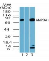 Western blot of human AMPDA1 inumouse skeletal muscle lysate in the 1) absence, 2) presence of immunizing peptide and 3)?rat skeletal muscle using antibody at 1 ug/ml.