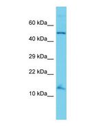Western blot of ANAPC15 Antibody - N-terminal region with human HT1080 cells lysate.
