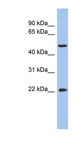 ANKH antibody LS-C111261 Western blot of THP-1 cell lysate.