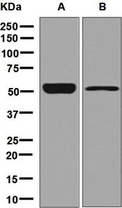 Western blot analysis on (A) fetal brain and (B) 293T cell lysates using anti-ANKH antibody.
