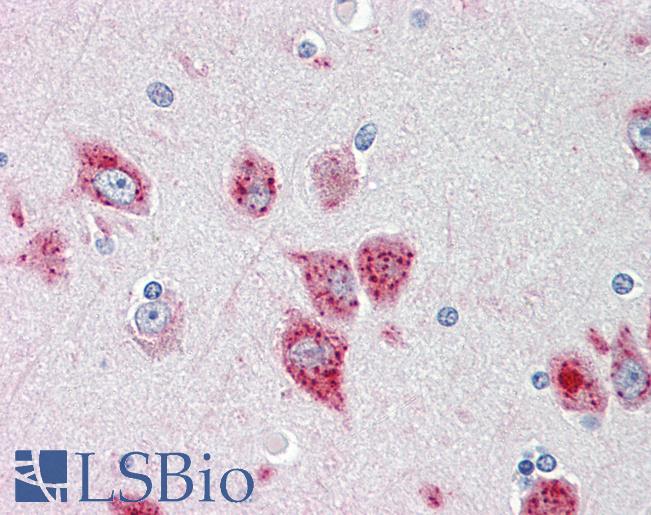 Anti-ANKH / ANK antibody IHC staining of human brain, cortex. Immunohistochemistry of formalin-fixed, paraffin-embedded tissue after heat-induced antigen retrieval.