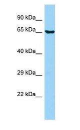 EB-1 / ANKS1B antibody Western Blot of HepG2.