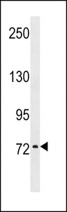 KAL1 Antibody western blot of MDA-MB453 cell line lysates (35 ug/lane). The KAL1 antibody detected the KAL1 protein (arrow).