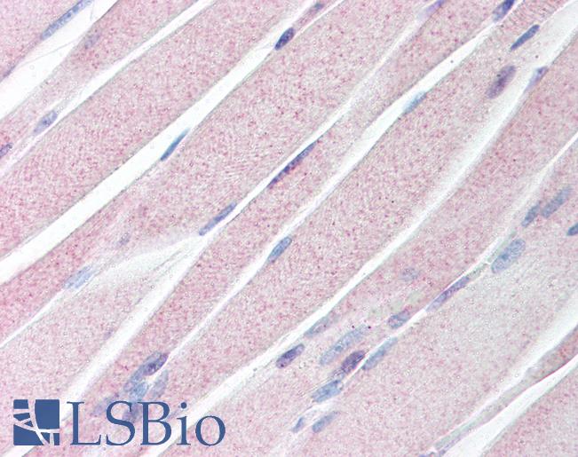 Anti-KAL1 / Anosmin antibody IHC of human skeletal muscle. Immunohistochemistry of formalin-fixed, paraffin-embedded tissue after heat-induced antigen retrieval. Antibody LS-B98 concentration 40 ug/ml.