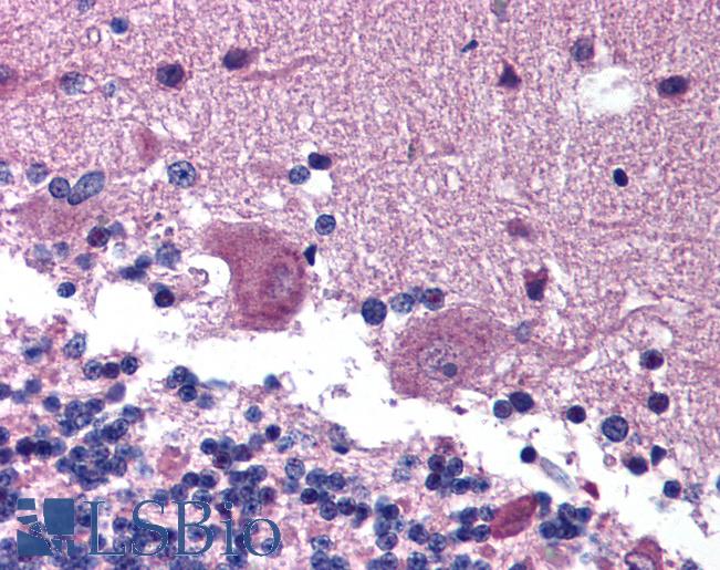 Anti-KAL1 / Anosmin antibody IHC of human brain, cerebellum. Immunohistochemistry of formalin-fixed, paraffin-embedded tissue after heat-induced antigen retrieval. Antibody LS-B99 concentration 5 ug/ml.