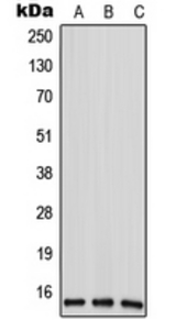 Western blot analysis of ANP32D expression in HeLa (A); mouse liver (B); rat liver (C) whole cell lysates.