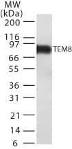 Western blot detection of TEM8 in TEM8 transfected cell lysate using antibody at 1 ug/ml.
