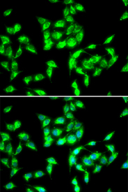 Immunofluorescence blot of HeLa cell using ANTXR1 antibody. Blue: DAPI for nuclear staining.