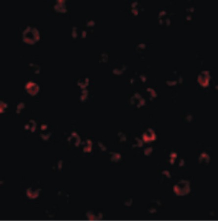 Immunofluorescence of ATR in K562 cells with ATR antibody at 10 ug/ml.