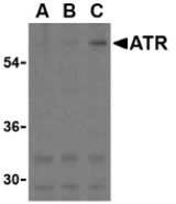 Western blot of ATR in K562 cell lysates with ATR antibody at (A) 0.5, (B) 1, and (C) 2 ug/ml.