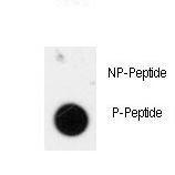 Dot blot of anti-Phospho-ANTXR1-pY425 Antibody on nitrocellulose membrane. 50ng of Phospho-peptide or Non Phospho-peptide per dot were adsorbed. Antibody working concentrations are 0.5ug per ml.