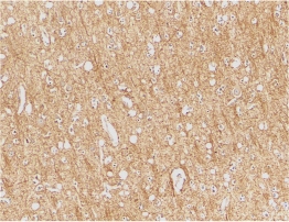 IHC of human brain tissue using ATR antibody at 2 ug/ml.