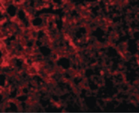 Immunofluorescence of ATR in Human Brain cells with ATR antibody at 10 ug/ml.