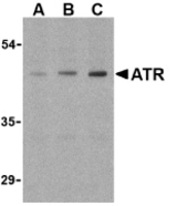 Western blot of ATR in HepG2 cell lysates with ATR antibody at (A) 0.5, (B) 1, and (C) 2 ug/ml.