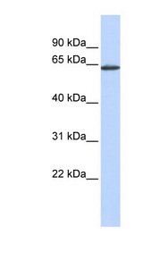 ANTXR1 / TEM8 antibody LS-C111251 Western blot of MCF7 cell lysate.