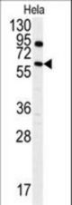 Western blot of anti-ANTXR1 Antibody (Y382) in HeLa cell line lysates (35 ug/lane). ANTXR1 (arrow) was detected using the purified antibody.