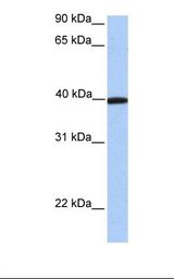 NTERA2 cell lysate. Antibody concentration: 1.0 ug/ml. Gel concentration: 12%.
