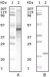 Western blot using Apoa5 mouse monoclonal antibody against human serum (A) and Apoa5 recombinant protein (B).