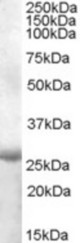 Antibody (1 ug/ml) staining of Human Muscle lysate (35 ug protein in RIPA buffer). Primary incubation was 1 hour. Detected by chemiluminescence.