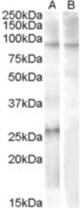 Antibody (1 ug/ml) staining of Human Heart lysate (35 ug protein in RIPA buffer) with (B) and without (A) blocking with the immunizing peptide. Primary incubation was 1 hour. Detected by chemiluminescence.