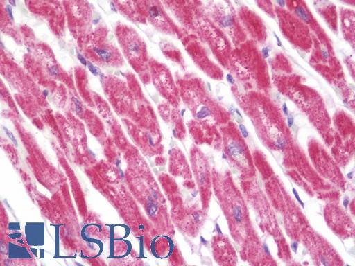Anti-TNFSF4 / OX40L antibody IHC staining of human heart. Immunohistochemistry of formalin-fixed, paraffin-embedded tissue after heat-induced antigen retrieval. Antibody LS-B10542 dilution 1:100.