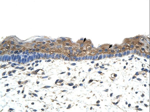 APOBEC2 antibody LS-C30626 was used in IHC to stain formalin-fixed, paraffin-embedded human skin.